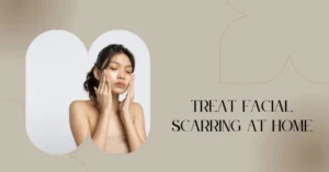 Treat Facial Scarring at Home