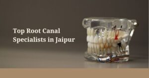 Top Root Canal Specialists in Jaipur