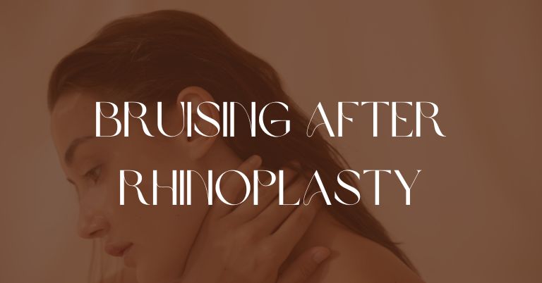 Bruising After Rhinoplasty